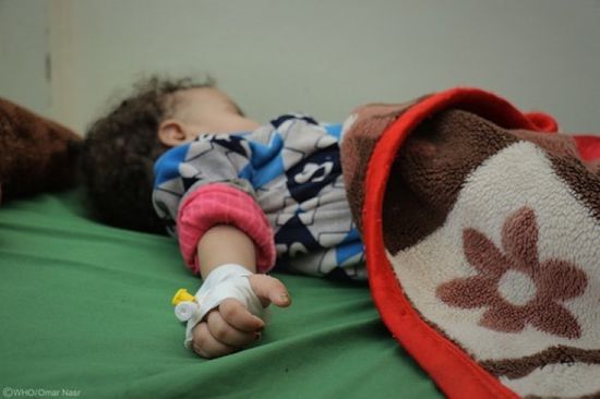 "الصحة العالمية": 22% ارتفاعًا بسوء التغذية الوخيم بين الأطفال