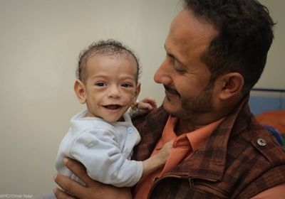 "الصحة العالمية": دعم 100 مركز تغذية علاجية بالأدوية والحليب