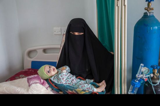 "الصحة العالمية": اليمن على مشارف مجاعة واسعة