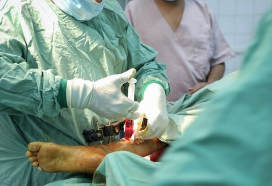 أطباء بلا حدود: 1500 جراحة في "السلخانة" خلال عام