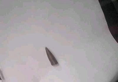 نجاة سيدة في إب من رصاصة راجعة