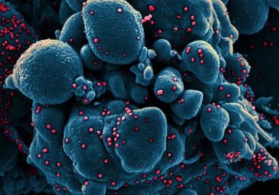 3 مصابين بكورونا في ساحل حضرموت