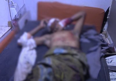 انفجار لغم حوثي في شاب بمديرية ذُباب