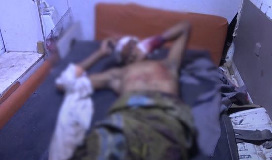 انفجار لغم حوثي في شاب بمديرية ذُباب