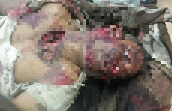 ضحيتان في تصادم سيارة نقل ودراجة نارية بتبن