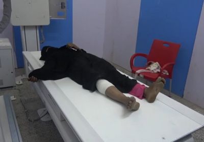 شاهد.. إصابة سيدة بعيار ناري حوثي في حيس