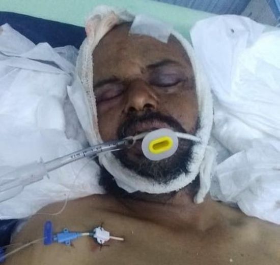 حالته خطرة.. دهس ضابط في أمن العند بتبن