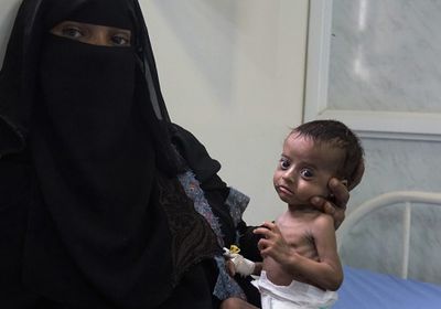 تحذيرات المجاعة في اليمن.. البارود الذي يحرق الجميع