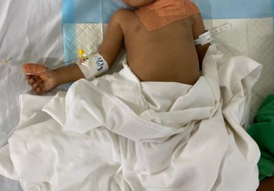 "أطباء بلا حدود": قصف المدنيين بحيس انتهاك للقانون الدولي