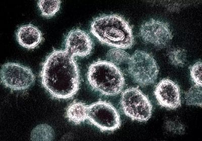 من بين 51 عينة.. 30 إصابة مؤكدة بكورونا في وادي حضرموت