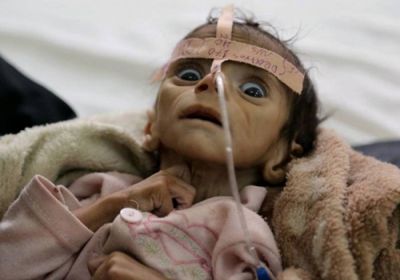 الجوع في اليمن.. غول متوحش يفترس البطون