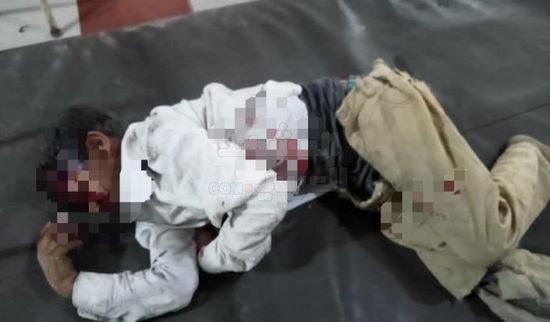 إسعاف طفلين دهستهما سيارة بالحبيلين لـ "ردفان العام"