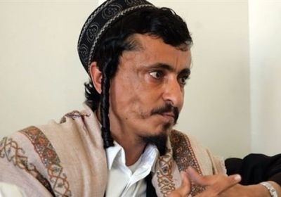 السفير البريطاني يطالب الحوثيين بإطلاق سراح "مرحبي"