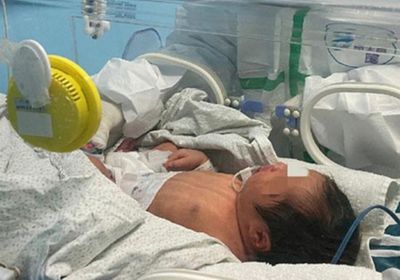 الأولى من نوعها.. إصابة رضيعة بفيروس كورونا في تعز