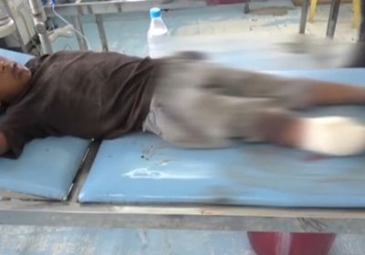 بالفيديو.. نيران حوثية تصيب طفلًا بهجوم على حيس