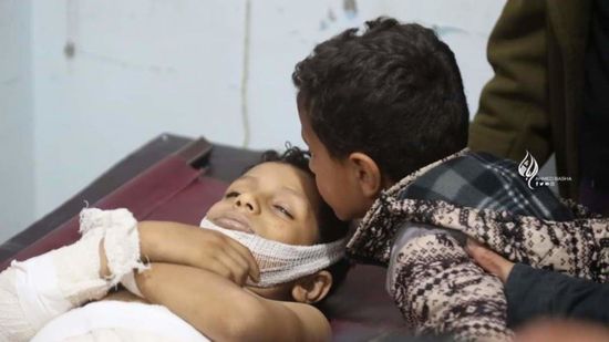  الأطفال في زمن الحرب الحوثية.. دماء يسيلها إرهاب المليشيات