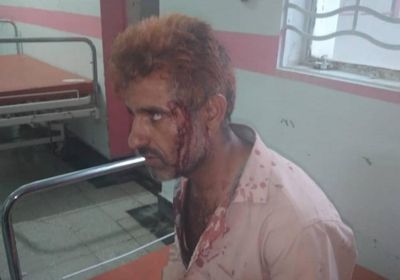 الضرب بـ"أعقاب البنادق" عقوبة فصل الربط المخالف في تعز