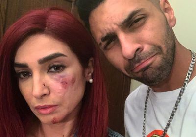 أول صورة لـ روجينا بعد إصابتها في تصوير "بنت السلطان"