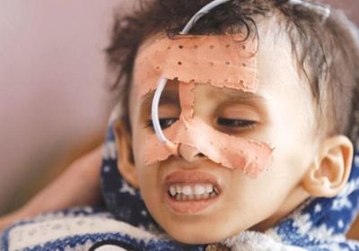 دعم الرعاية الصحية.. جهود أممية لكبح جماح أعباء الحرب الحوثية