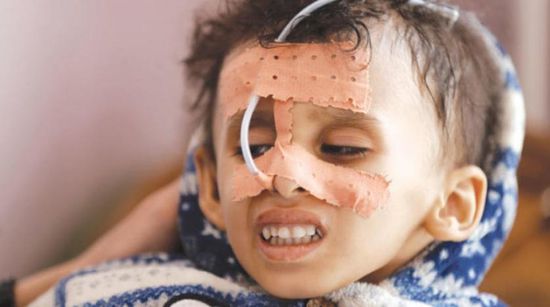دعم الرعاية الصحية.. جهود أممية لكبح جماح أعباء الحرب الحوثية