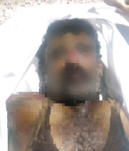 بعيارين في القلب.. تصفية جندي جنوبي مختطف بأبين