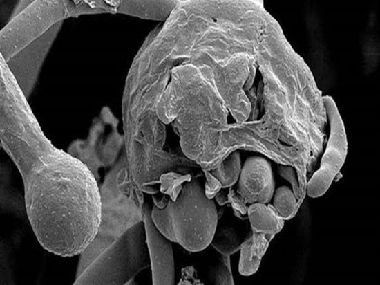  الفطر الأسود المقترن بكورونا يظهر في سوريا
