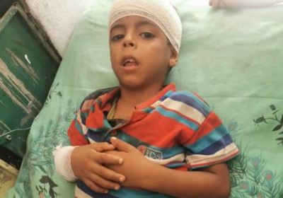 قصف حوثي يصيب طفلًا بجروح في ثره