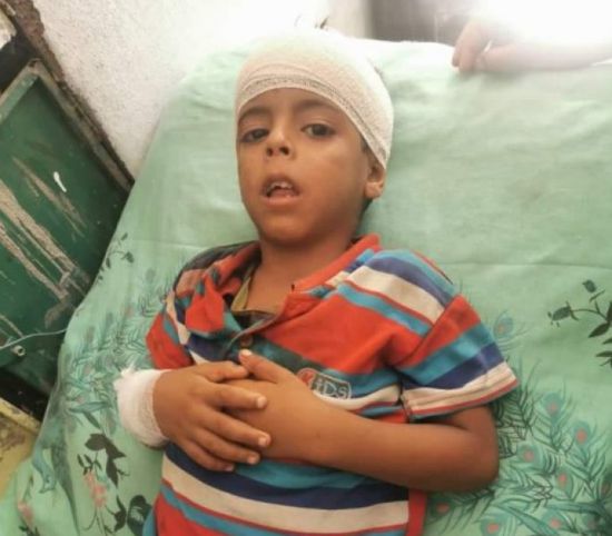 قصف حوثي يصيب طفلًا بجروح في ثره