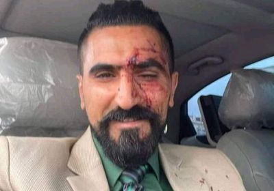 محاولة اغتيال محامي الشاب الأغبري داخل محكمة صنعاء