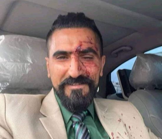 11 شخصا هاجموه.. تفاصيل محاولة اغتيال محامي الأغبري