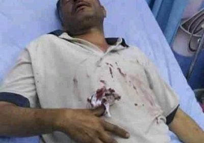 عصابة مُسلحة تطعن صحفيًا بصنعاء أمام أطفاله