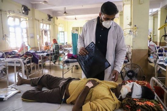 الهند تسجل أكثر من 45 ألف إصابة بالفطر الأسود