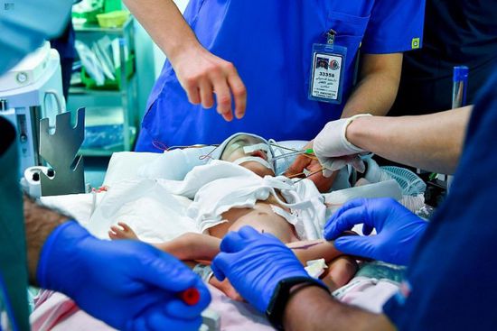 25 طبيبًا سعوديًا يبدأون فصل التوأم السيامي