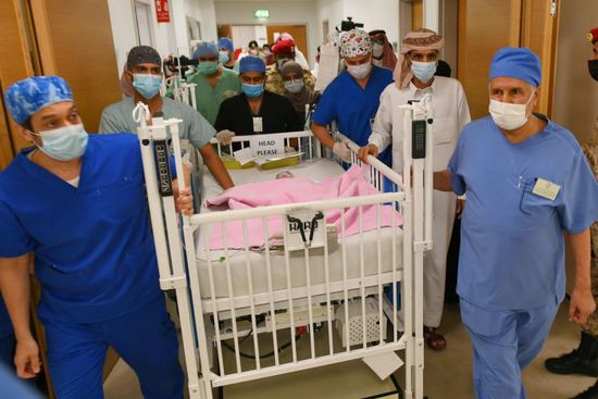 نجاح عملية فصل التوأم الطفيلي عائشة في الرياض
