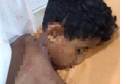 وفاة طفل متأثرا بإصابته برصاص مسلح في إب