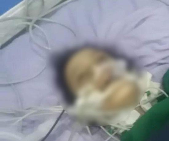 شكوى لانتزاع حق "بشرى" من مافيا الصحة الحوثية بإب