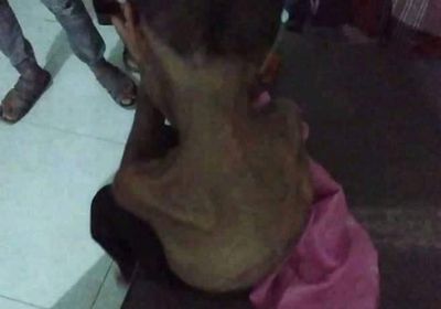 بمعاونة الزوجة.. أب يعذب نجله في حمام المنزل 4 أشهر