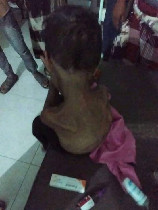 بمعاونة الزوجة.. أب يعذب نجله في حمام المنزل 4 أشهر