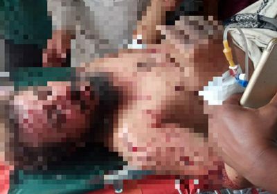 إصابة عامل نزع ألغام بجروح خطرة في الملاح