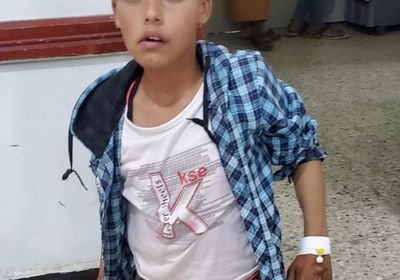 بينهم الأب.. 3 يتناوبون على تعذيب طفل في إب