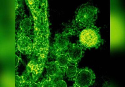 العراق يسجل 6 إصابات  بـ"الجمرة الخبيثة"