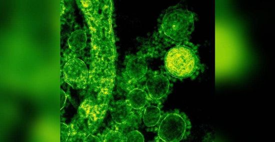 العراق يسجل 6 إصابات  بـ"الجمرة الخبيثة"