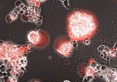 لا وفيات.. 15 إصابة بكورونا في ساحل حضرموت