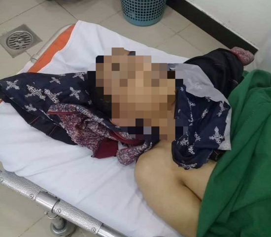 "عصابة طلاب" تقتل مراهقًا داخل مدرسته في صنعاء