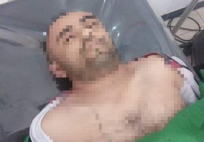 انتحار شاب في إب وسط ظروف غامضة