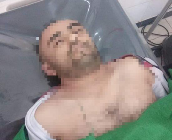 انتحار شاب في إب وسط ظروف غامضة