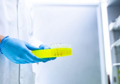 ألمانيا تقدم 2.3 مليون جرعة لقاح كورونا لمصر