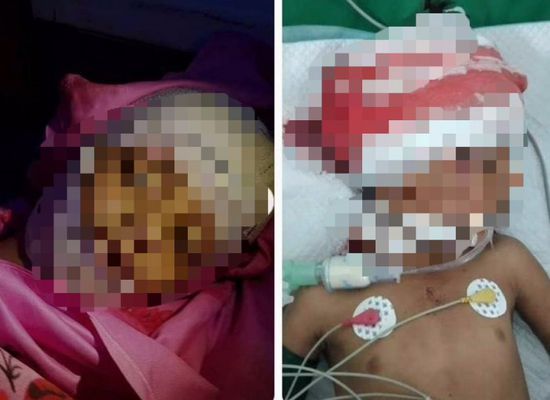 استشهاد طفل في القصف الحوثي على تعز