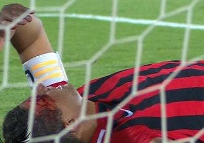 سعد سمير ينزف في أول مباراة بالدوري ويخرج مصابا