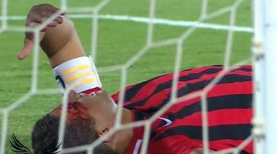 سعد سمير ينزف في أول مباراة بالدوري ويخرج مصابا